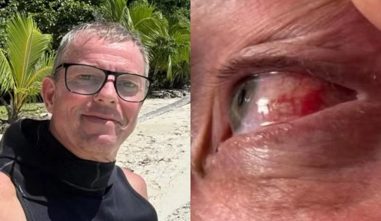 Empresário que sofria de coceira nos olhos