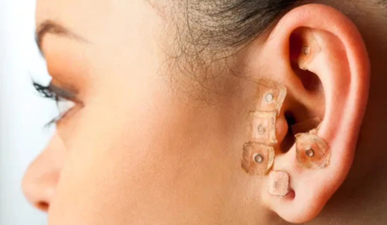 Mulher realizando auriculoterapia.