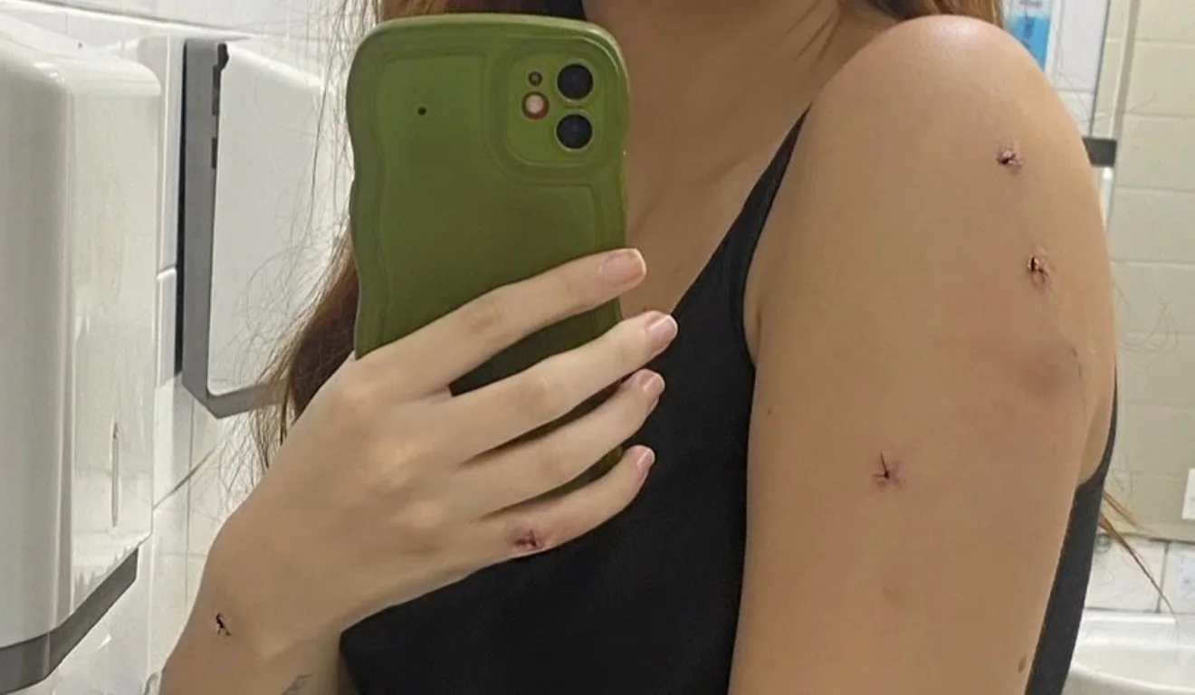 Ferimentos de Laura Sabino