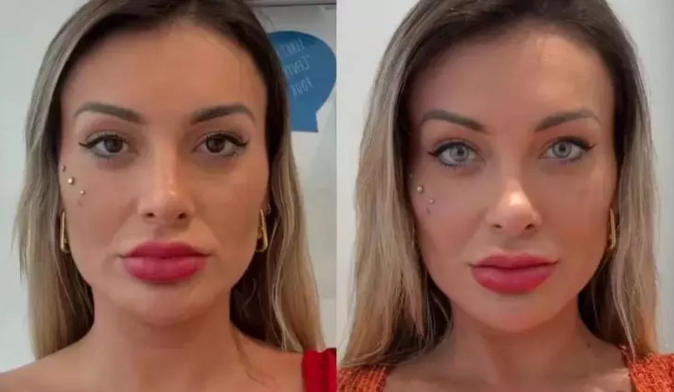 Andressa Urach antes e depois de mudar cor dos olhos para azul