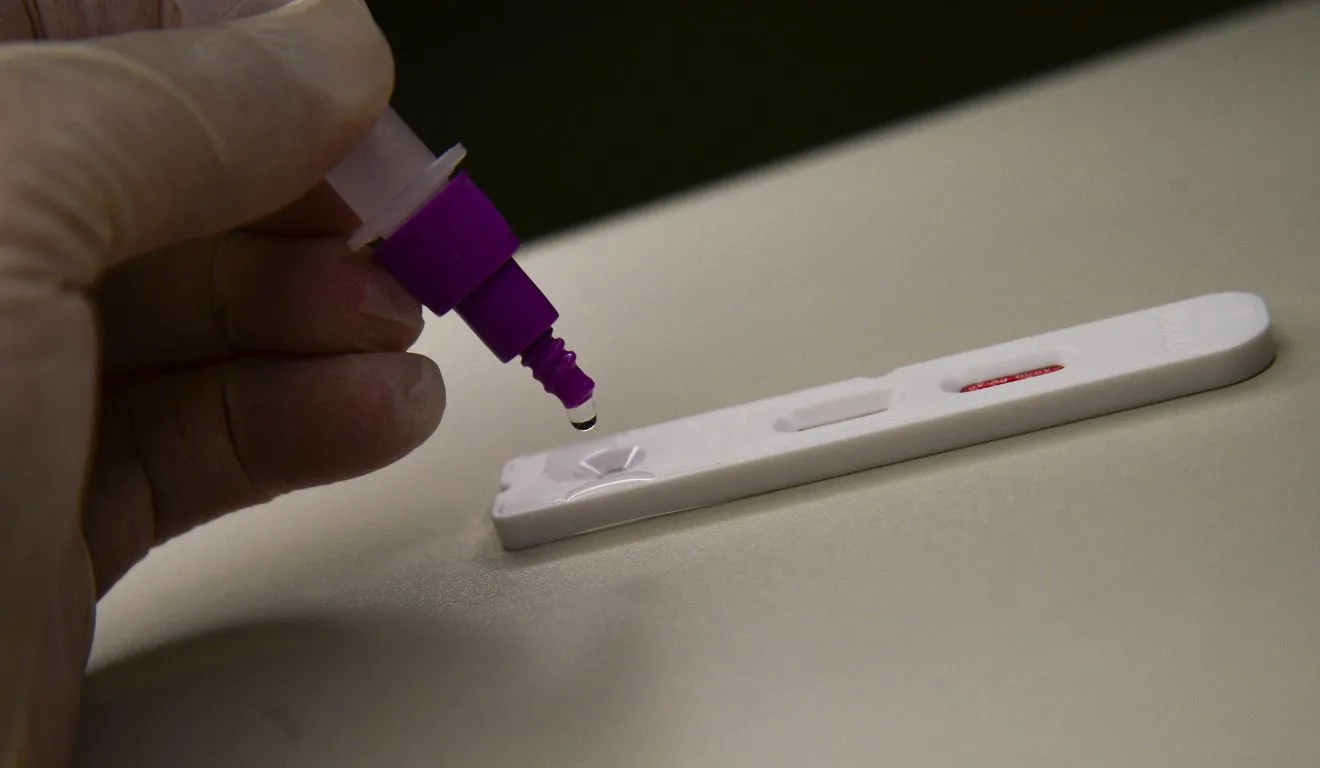 Teste para detecção de casos de Covid-19; Paraná registra mortes pela doença