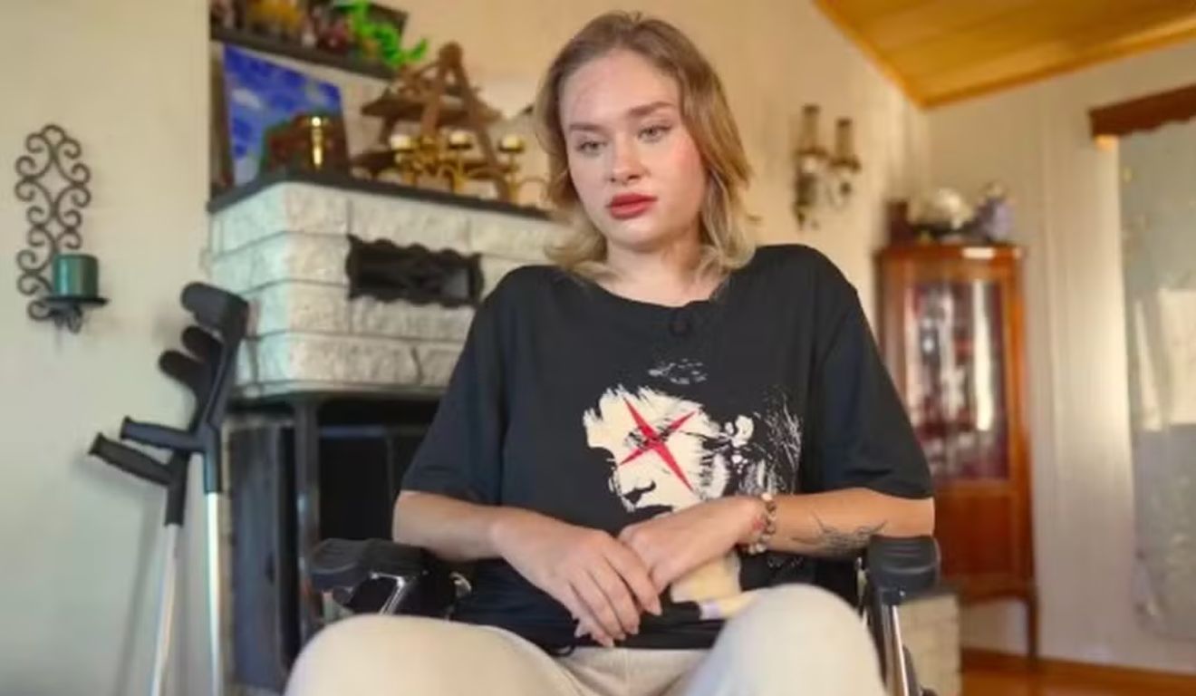 A modelo ucraniana Maria Kovalchuk, que foi escalpelada e torturada em Dubai