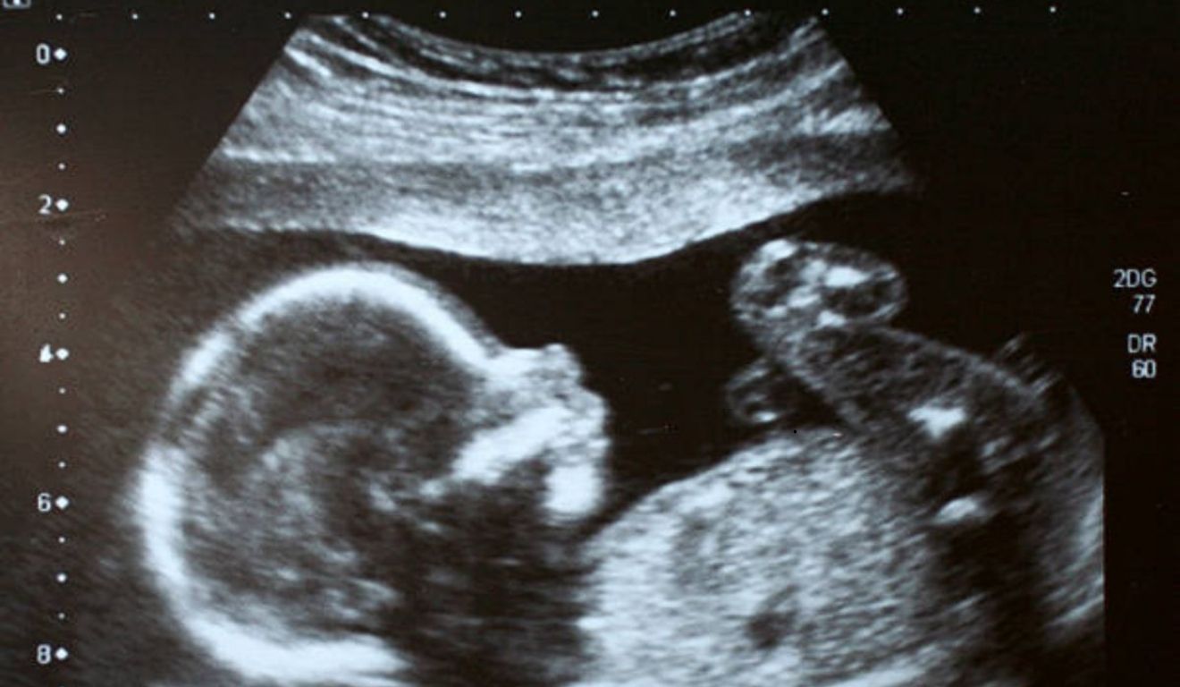 ultrassom de grávida