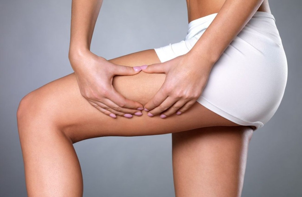 Celulite é um problema comum entre as mulheres, mas afetam ambos os sexos