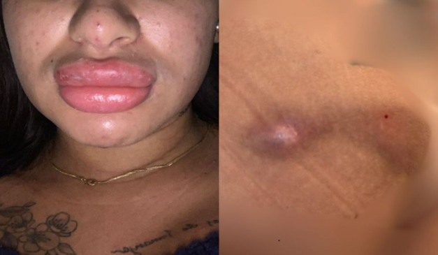 mulher deformadas após serem atendidas pela falsa biomédica