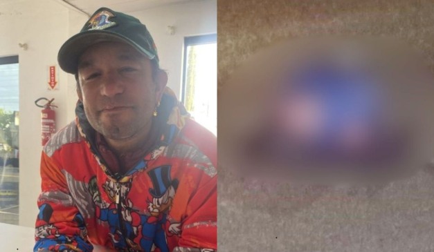 homem que teve corpo partido ao meio ao ser atropelado