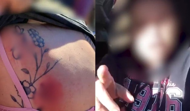 Motorista de aplicativo agredida por mulheres nas costas