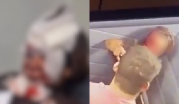 Mulher que foi espancada pelo namorado