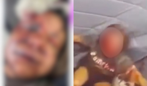 mulher que foi espancada pelo namorado