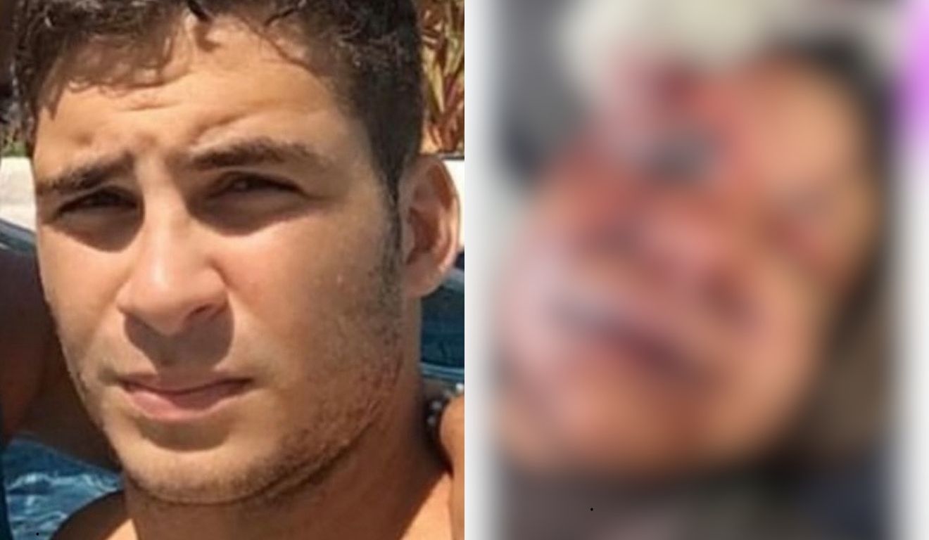 mulher espancada namorado