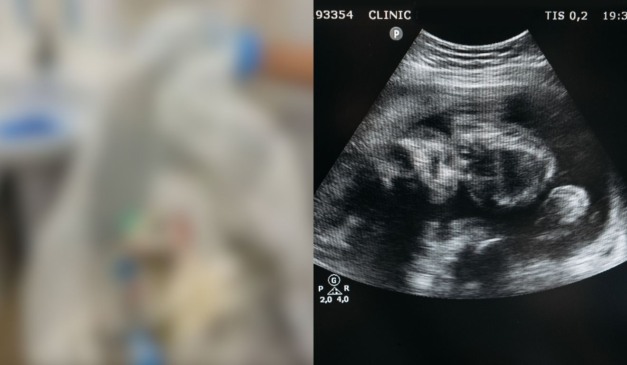 aborto clandestino em motel