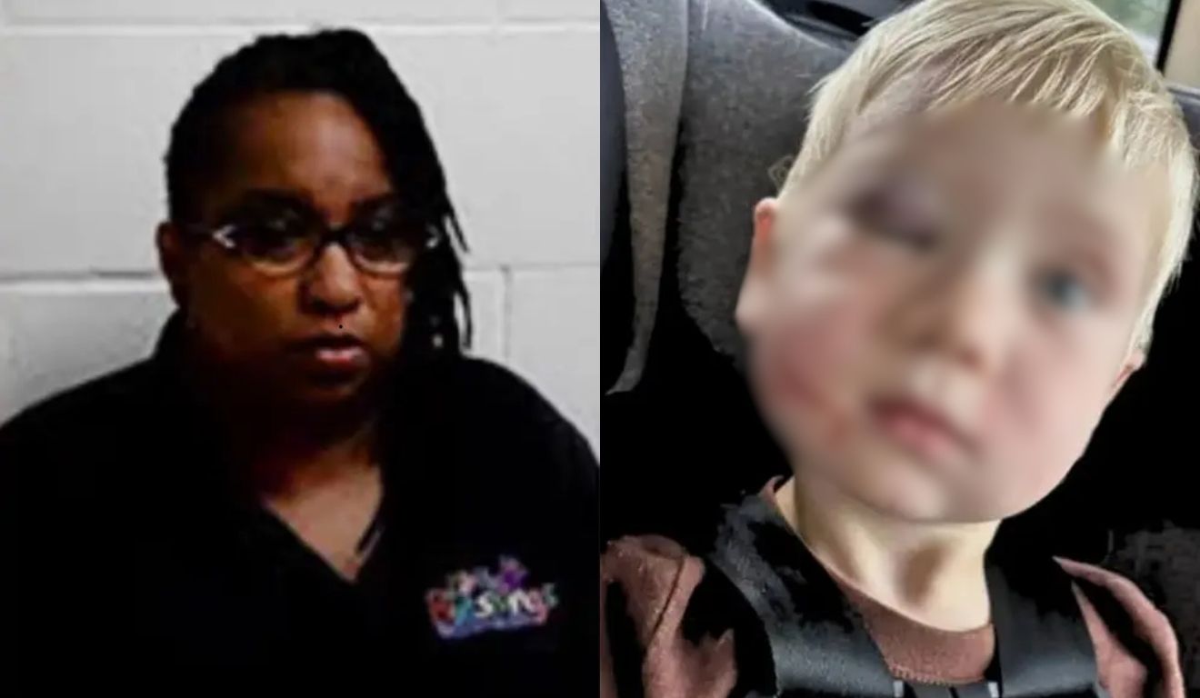 funcionária que foi demitida por olho roxo em bebê