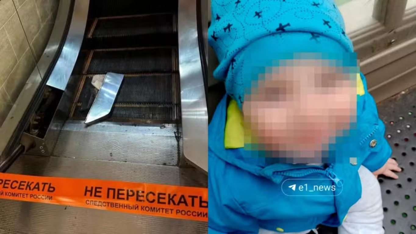 Criança que teve braço decepado