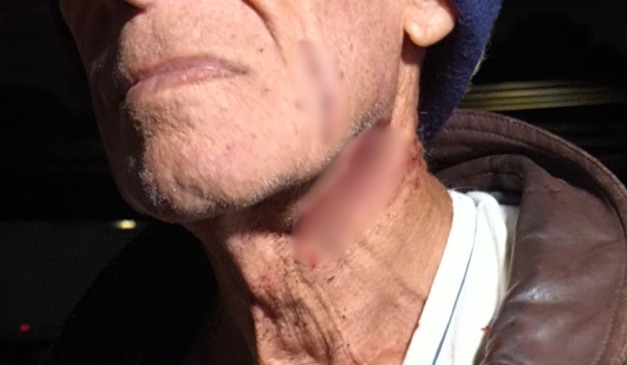 idoso que foi agredido pela vizinha em Curitiba