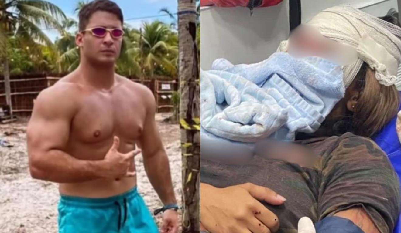 homem que agrediu mulher com socos no elevador e mulher indo para cirurgia