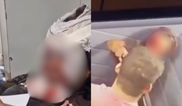 mulher espancada com 61 socos