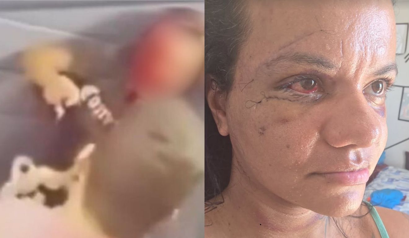 mulher que foi espancada por namorado em elevador