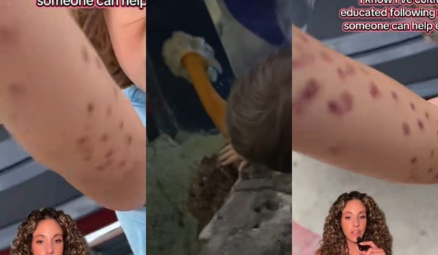 menino que foi atacado pelo polvo