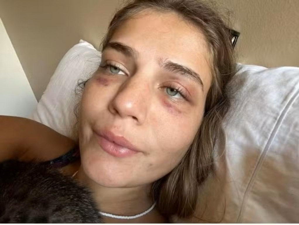 Jannah Nebbeling, modelo vítima de violência.