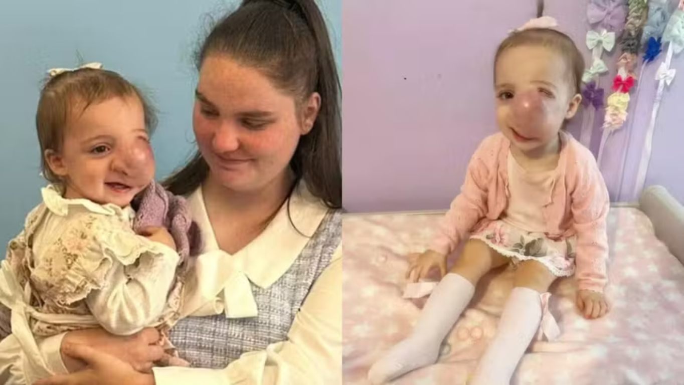 Bebê que morreu de câncer