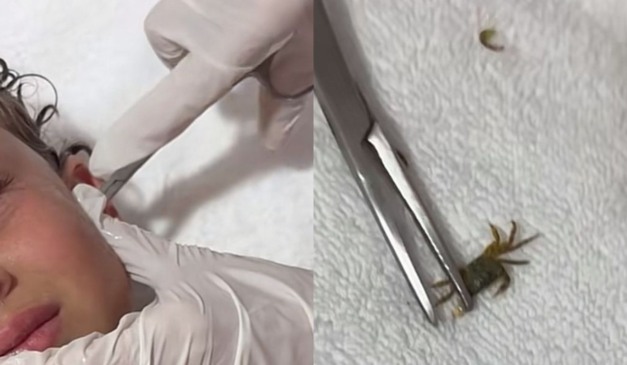 momento em que o caranguejo é retirado o do ouvido do menino