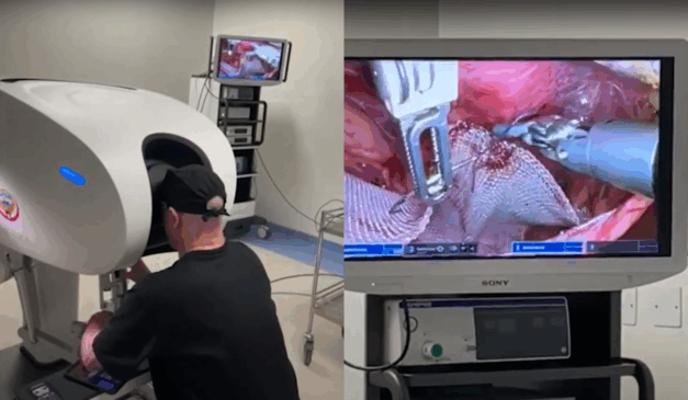 Um hospital paranaense bateu o recorde de maior cirurgia a distância do mundo. Na imagem, vemos o cirurgião sentado no console, enquanto observa por uma tela os movimentos que o robô está fazendo, controlado por ele.