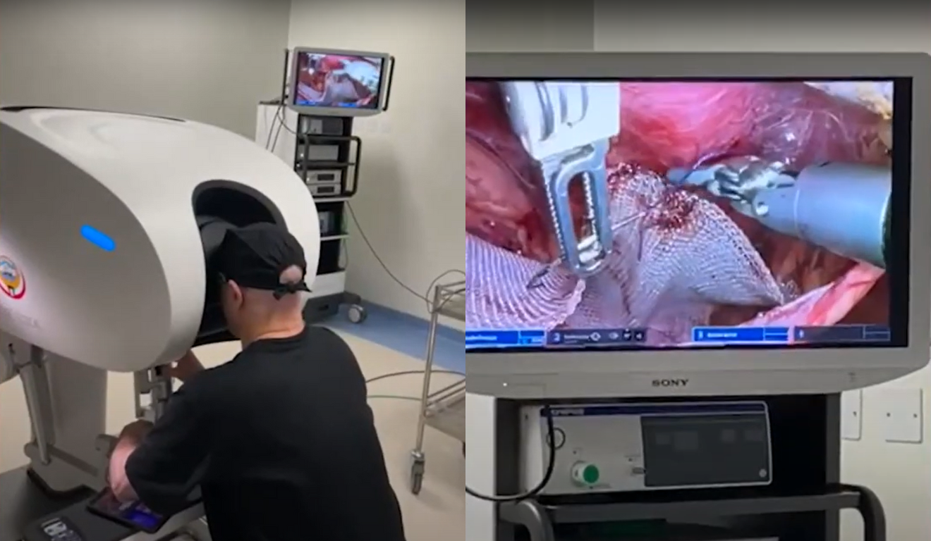 Um hospital paranaense bateu o recorde de maior cirurgia a distância do mundo. Na imagem, vemos o cirurgião sentado no console, enquanto observa por uma tela os movimentos que o robô está fazendo, controlado por ele.