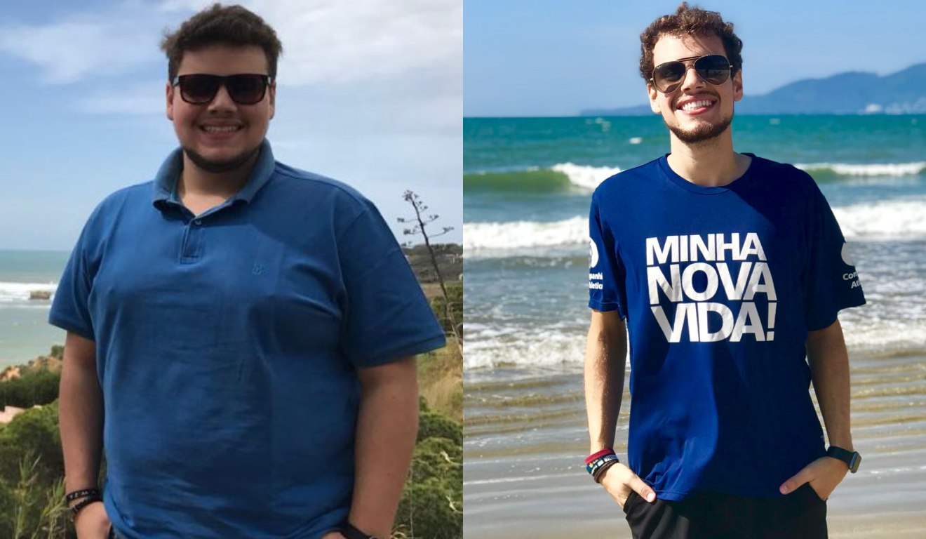 Cirurgia bariátrica