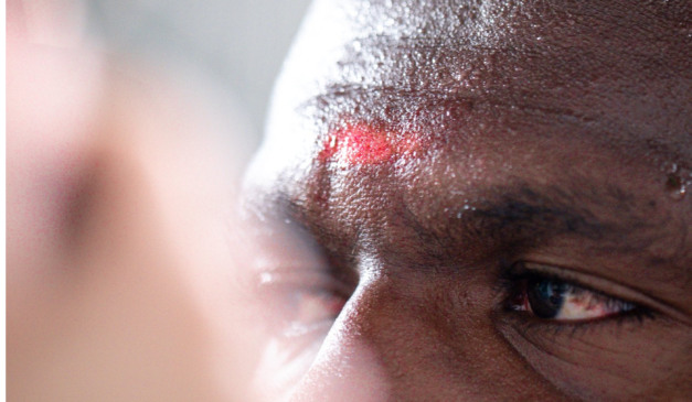 Jogador ficou com um ferimento na testa. (Foto: Reprodução/ Coritiba)