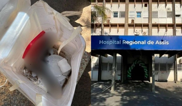 pé humano encontrado em reciclagem