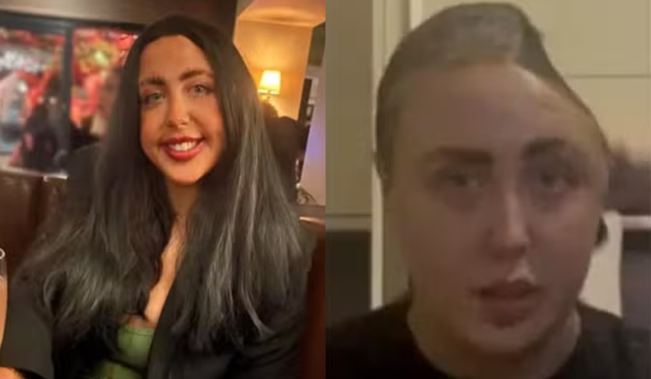 Jovem que perdeu parte do cérebro.