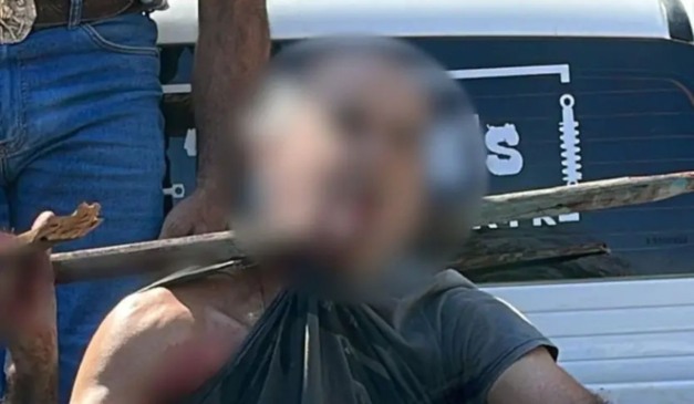 trabalhador que teve estaca de madeira atravessada no pescoço