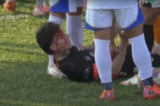 Diego, jogador acusado de ter cometido injúria racial. (Foto: Reprodução/ Transmissão FPF)