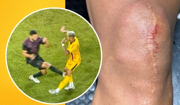 Imagem divulgada pelo Amazonas sobre a lesão do jogador Kevin Ramírez contra o Athletico.