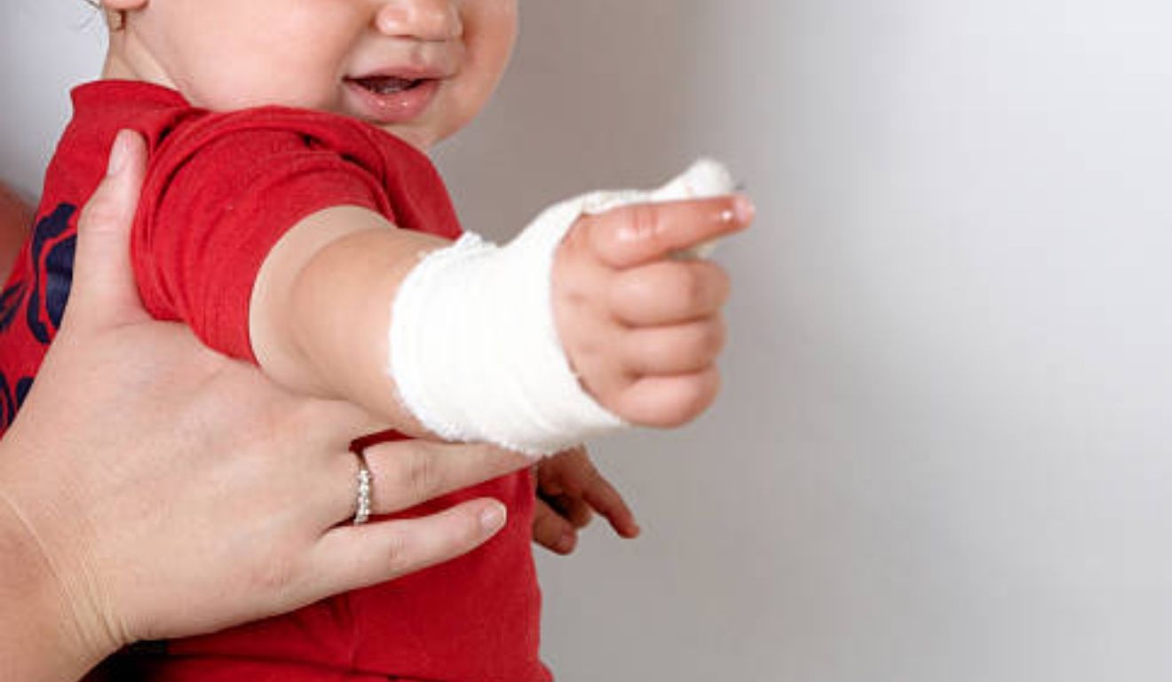 bebê com braço quebrado