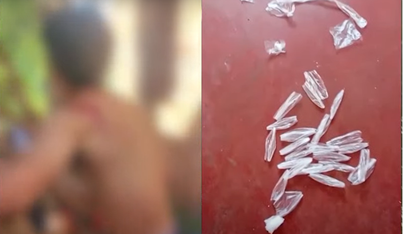 Confusão entre irmãos termina com jovem esfaqueado. Na imagem, vemos o jovem com ferimentos no ombro e os pacotes de cocaína que a irmã estava cortando.