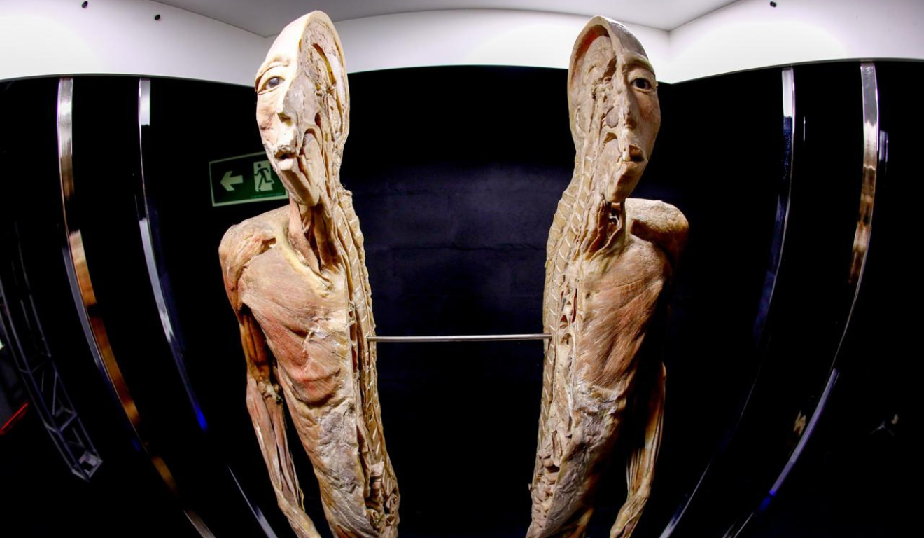 Peça de exposição Human Bodies – Maravilhas do Corpo Humano