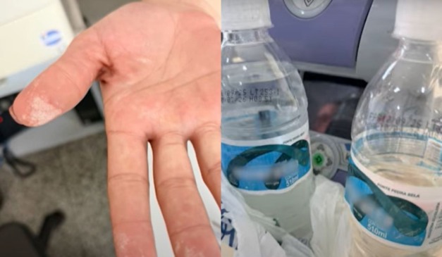 intoxicação água mineral