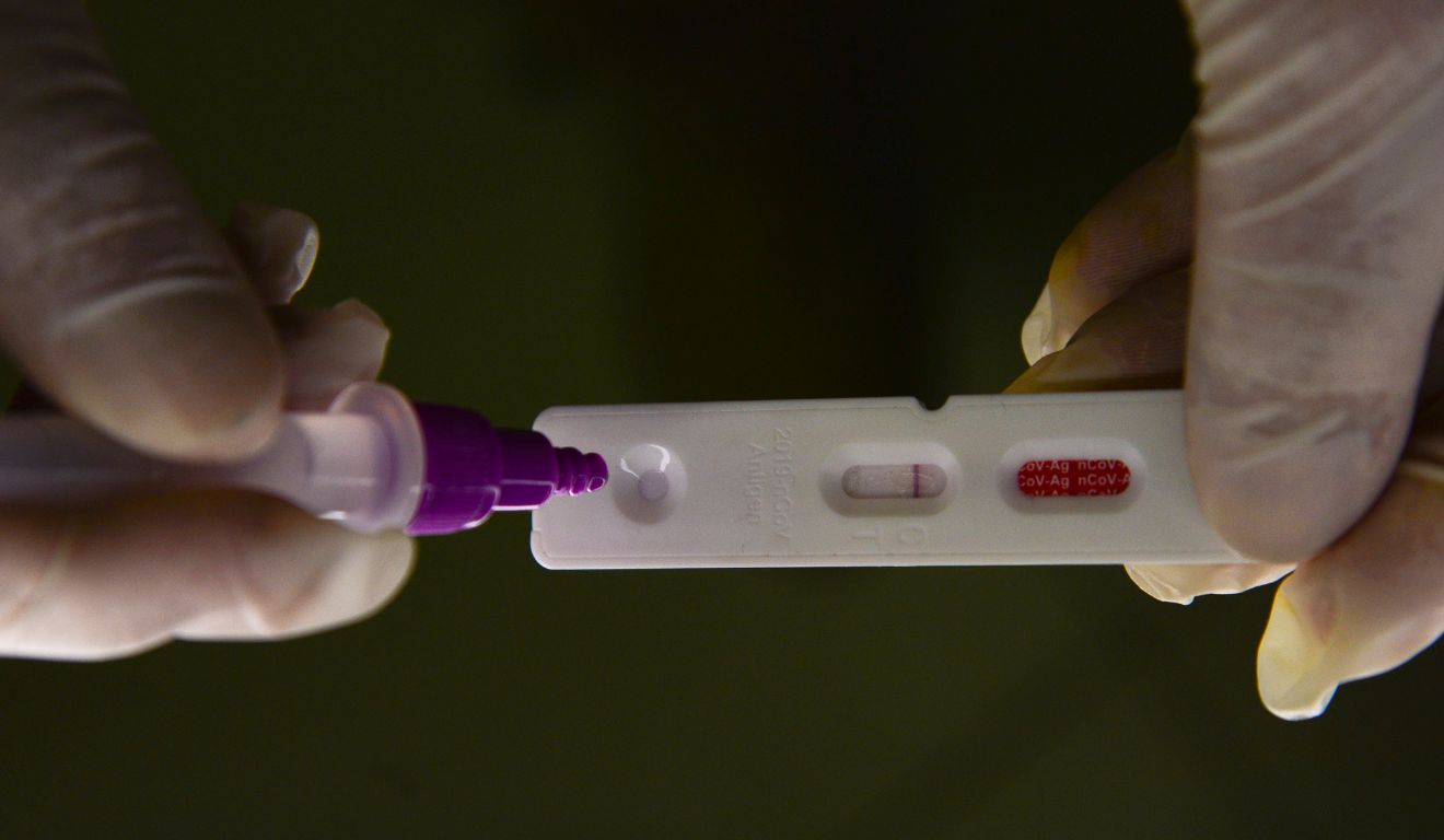 Teste de antígeno para diagnóstico de Covid-19; Paraná apresentou alta nas internações por doenças respiratórias