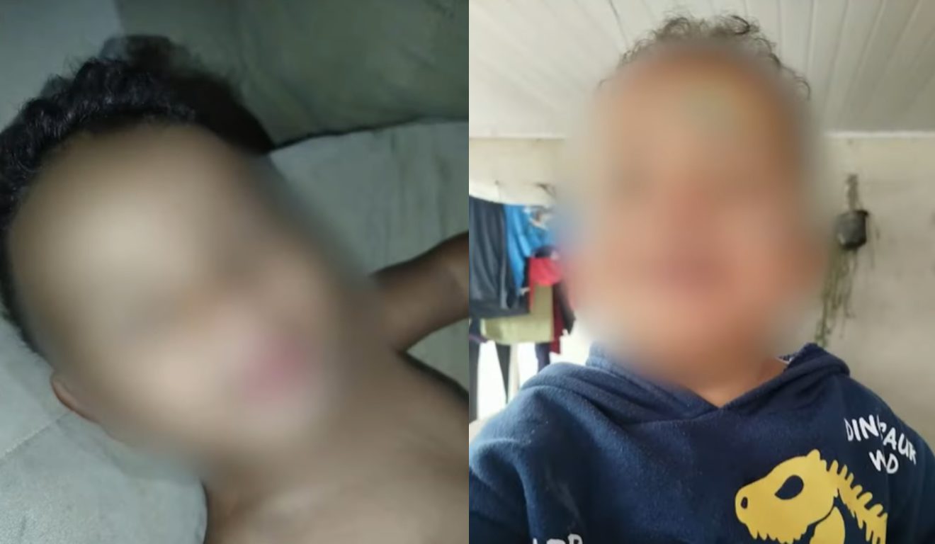 Bebê internado após se engasgar em creche em foto sem camisa e com moletom de dinossauro em montagem