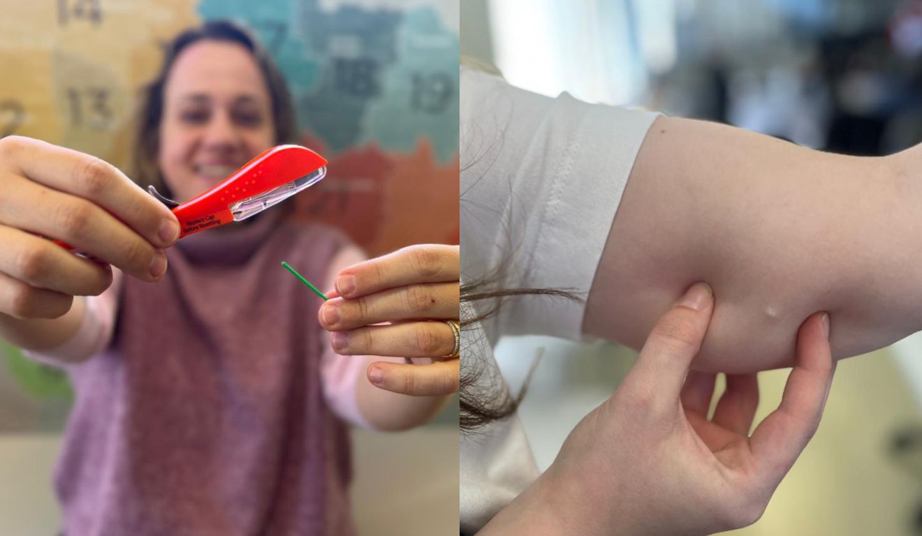 Colagem com fotos do  Implanon NXT, agora, disponível gratuitamente no paraná