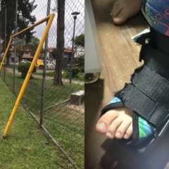 Montagem com imagens da trave que despencou e da perna do menino atingido