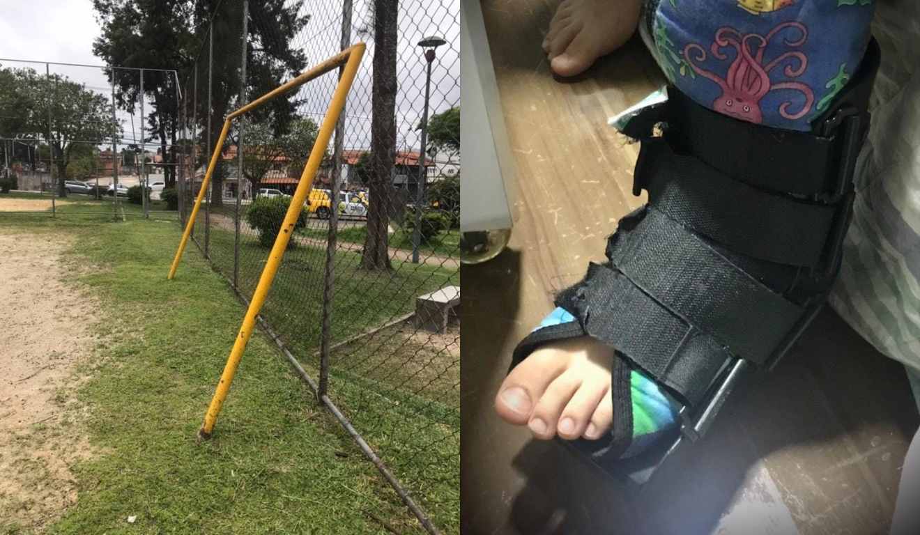Montagem com imagens da trave que despencou e da perna do menino atingido