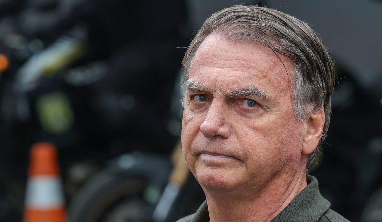 Jair Bolsonaro; ex-presidente deverá passar por operação