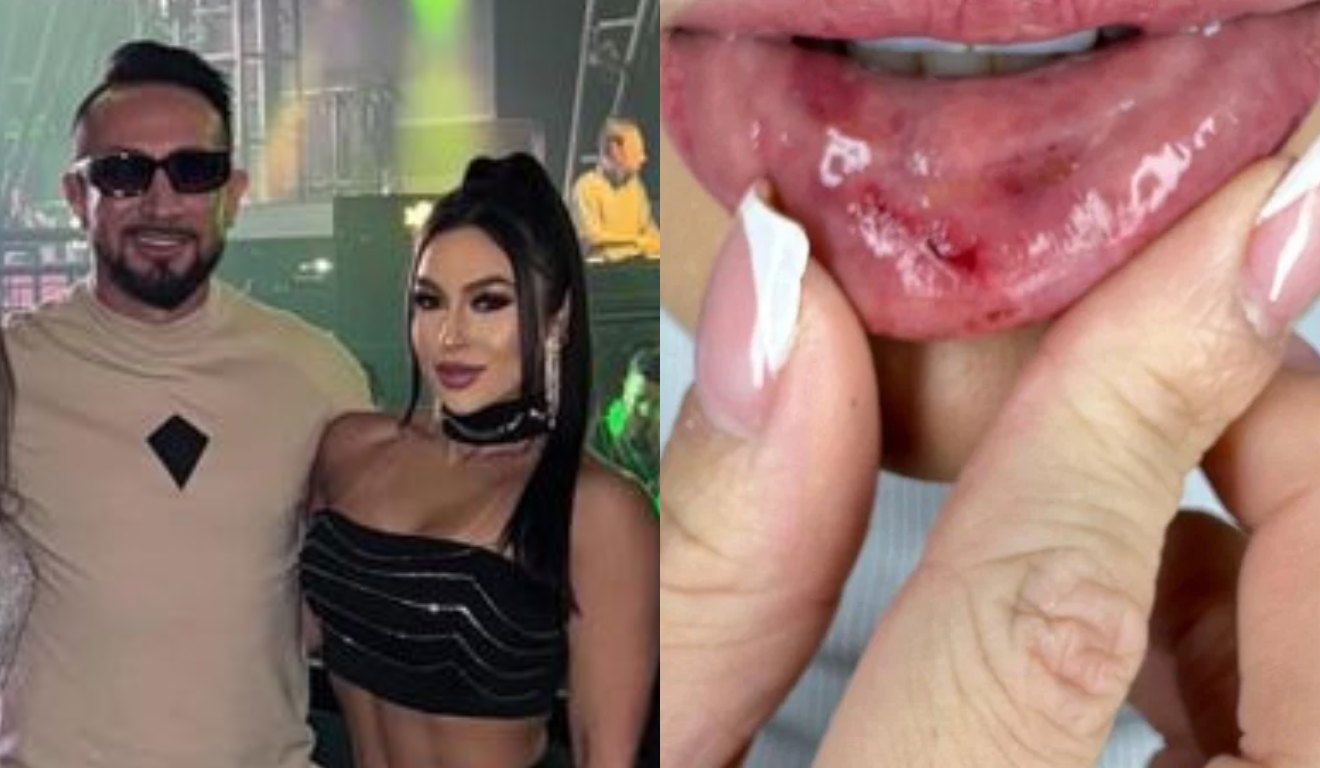 colagem com fotos de Kauany Tonndorf, de 24 anos e seu agressor