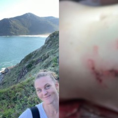 Colagem com fotos da psic&oacute;loga Fabiana Lenz, de 32 anos, foi atacada por uma capivara