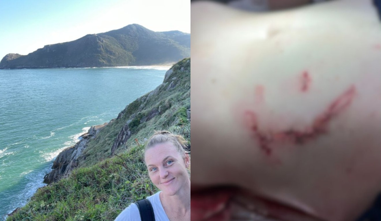 Colagem com fotos da psicóloga Fabiana Lenz, de 32 anos, foi atacada por uma capivara