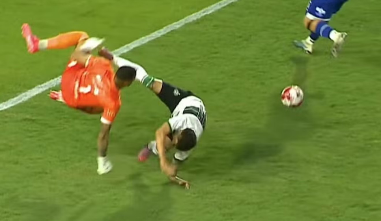 Momento em que Lucas Crepaldi, atacante do Coritiba, quebra o braço.