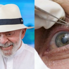 Colagem de fotos mostra o presidente Luiz In&aacute;cio Lula da Silva e o olho de um paciente que passou por cirurgia de catarata