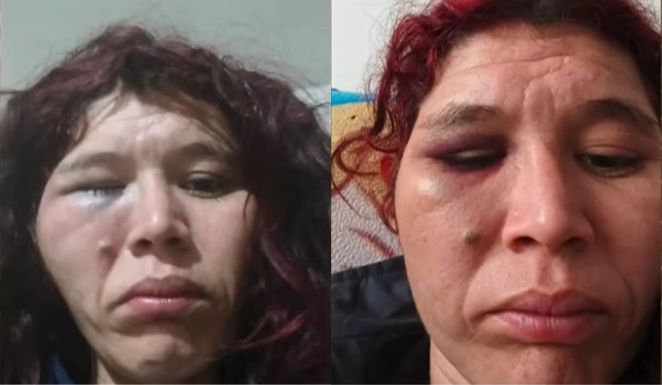 hematomas na mulher que foi encontrada morta em casa